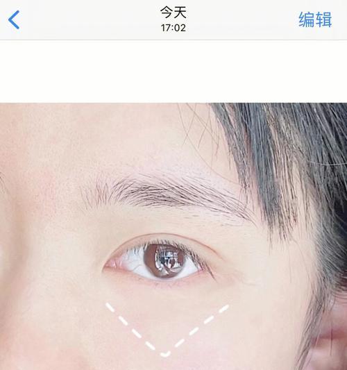 快速改善黑眼圈的窍门有哪些？如何有效缓解眼部疲劳？
